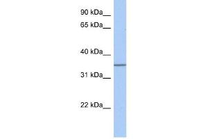 GLT6D1 antibody used at 1 ug/ml to detect target protein.