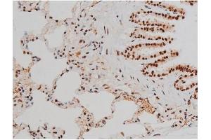 Immunohistochemistry (IHC) image for anti-Activating Transcription Factor 2 (ATF2) (pThr51), (pThr69) antibody (ABIN6256594)