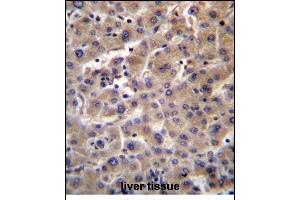 GUSB Antibody (C-term) (ABIN656383 and ABIN2845678) immunohistochemistry analysis in formalin fixed and paraffin embedded human liver tissue followed by peroxidase conjugation of the secondary antibody and DAB staining. (Glucuronidase beta 抗体  (C-Term))
