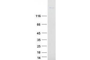 Western Blotting (WB) image for Sialic Acid Binding Ig-Like Lectin 1, Sialoadhesin (SIGLEC1) protein (Myc-DYKDDDDK Tag) (ABIN2713462)