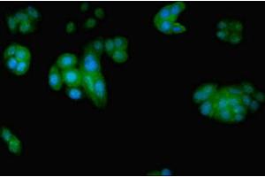 Immunofluorescent analysis of PC-3 cells using ABIN7152209 at dilution of 1:100 and Alexa Fluor 488-congugated AffiniPure Goat Anti-Rabbit IgG(H+L) (EIF5 抗体  (AA 1-431))