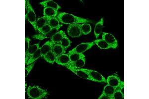 Immunofluorescence (IF) image for anti-Chemokine (C-C Motif) Receptor 5 (CCR5) antibody (ABIN6939154)