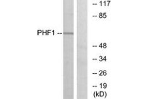 Western blot analysis of extracts from HeLa cells, using PHF1 Antibody. (PHF1 抗体  (AA 345-394))