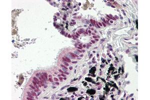 Human Lung, Respiratory Epithelium: Formalin-Fixed, Paraffin-Embedded (FFPE) (DNAJC3 抗体  (AA 270-462))