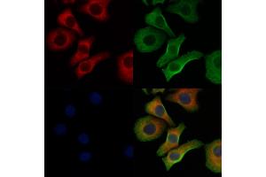 ABIN6260159 and ABIN6278363 staining Hela cells by IF/ICC. (AVPR1A 抗体  (C-Term))