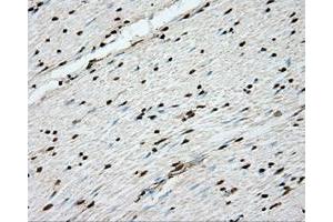 Immunohistochemical staining of paraffin-embedded Kidney tissue using anti-ERCC1 mouse monoclonal antibody. (ERCC1 抗体)