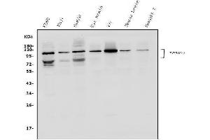 Western blot analysis of DR6/TNFRSF21 using anti-DR6/TNFRSF21 antibody (ABIN7603008).