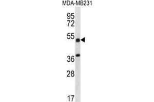 Western Blotting (WB) image for anti-Tripartite Motif Containing 10 (TRIM10) antibody (ABIN2996897) (TRIM10 抗体)