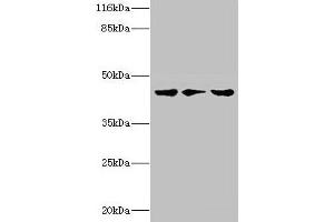 Western blot All lanes: PSKH2 antibody at 2 μg/mL Lane 1: Hela whole cell lysate Lane 2: Mouse heart tissue Lane 3: Rat gonad tissue Secondary Goat polyclonal to rabbit IgG at 1/10000 dilution Predicted band size: 44 kDa Observed band size: 44 kDa (PSKH2 抗体  (AA 63-320))