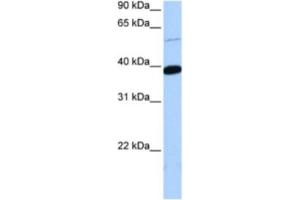 Western Blotting (WB) image for anti-Zinc Finger Protein 562 (ZNF562) antibody (ABIN2463443) (ZNF562 抗体)