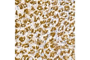Immunohistochemistry of paraffin-embedded Rat stomach using  antibody (ABIN7265531) at dilution of 400 (40x lens).
