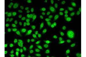 Immunofluorescence analysis of U2OS cells using PPL antibody (ABIN5974178). (PPL 抗体)