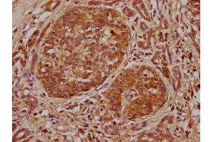 Immunohistochemistry (IHC) image for anti-E74-Like Factor 3 (Ets Domain Transcription Factor, Epithelial-Specific) (ELF3) (AA 147-371) antibody (ABIN7152094)