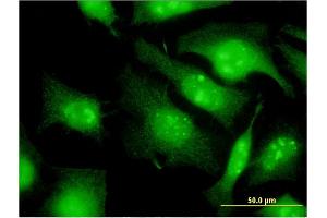 Immunofluorescence of monoclonal antibody to EIF2S3 on HeLa cell. (EIF2S3 抗体  (AA 383-472))