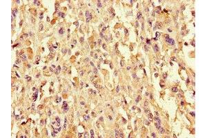 Immunohistochemistry (IHC) image for anti-Cysteinyl Leukotriene Receptor 1 (CYSLTR1) (AA 298-337) antibody (ABIN7149074)