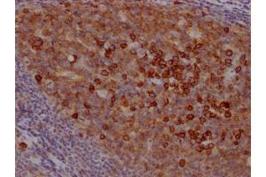 IHC image of ABIN7127402 diluted at 1:100 and staining in paraffin-embedded human tonsil tissue performed on a Leica BondTM system. (Recombinant CD38 抗体)