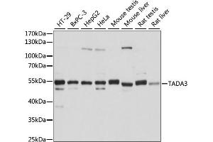 Western blot analysis of extracts of various cell lines, using T antibody (ABIN7270900) at 1:1000 dilution. (TADA3L 抗体  (AA 270-369))