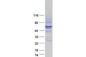 Validation with Western Blot