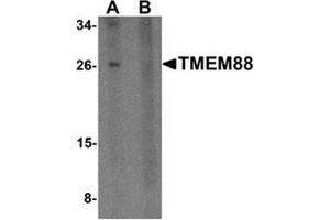 Western blot analysis of TMEM88 in human brain tissue lysate with TMEM88 antibody at 1 μg/ml in (A) the absence and (B) the presence of blocking peptide. (TMEM88 抗体  (C-Term))