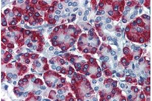 Human Pancreas: Formalin-Fixed, Paraffin-Embedded (FFPE) (SSR1 抗体  (AA 33-287))