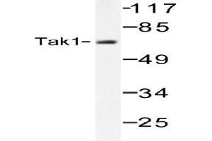 Western blot (WB) analysis of Tak1 antibody in extracts from HepG2 cells. (TR4 抗体)