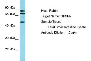 Host: Rabbit Target Name: GPSM2 Sample Tissue: Human Fetal Small Intestine Antibody Dilution: 1ug/ml (GPSM2 抗体  (N-Term))