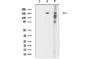 anti-TEK Tyrosine Kinase, Endothelial (TEK) (pTyr992) antibody
