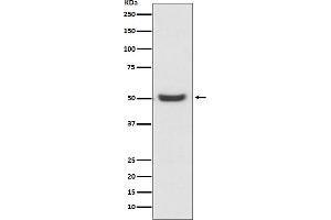 Western blot analysis of PDIA6 expression in K562 cell lysate.