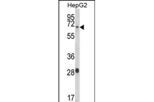 Western blot analysis of WAC Antibody (Center) (ABIN653490 and ABIN2842908) in HepG2 cell line lysates (35 μg/lane). (WAC 抗体  (AA 284-313))