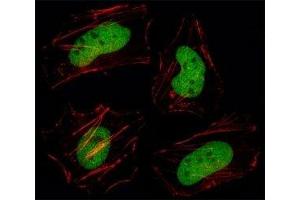 Fluorescent image of HeLa cell stained with HDAC1 antibody at 1:25. (HDAC1 抗体  (AA 449-482))