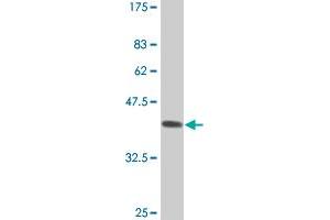 Western Blot detection against Immunogen (37. (STMN2 抗体  (AA 73-179))