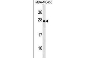 TRDC Antibody (Center) (ABIN1538630 and ABIN2838134) western blot analysis in MDA-M cell line lysates (35 μg/lane). (TRDC 抗体  (AA 79-106))