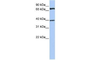 WB Suggested Anti-MPP5 Antibody Titration:  0. (MPP5 抗体  (N-Term))