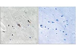 Immunohistochemistry analysis of paraffin-embedded human brain, using Gab2 (Phospho-Tyr643) Antibody. (GAB2 抗体  (pTyr643))