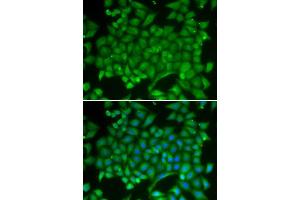Immunofluorescence analysis of MCF-7 cell using RAB11A antibody. (RAB11A 抗体  (AA 1-216))