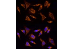 Immunofluorescence (IF) image for anti-Acyl-CoA Synthetase Long-Chain Family Member 4 (ACSL4) (AA 1-280) antibody (ABIN6136458)