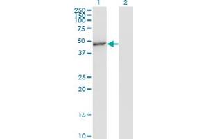 Western Blot analysis of MAPK8 expression in transfected 293T cell line by MAPK8 monoclonal antibody (M05), clone 4H5. (JNK 抗体  (AA 318-427))