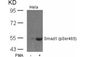 Image no. 1 for anti-SMAD, Mothers Against DPP Homolog 1 (SMAD1) (pSer465) antibody (ABIN319257) (SMAD1 抗体  (pSer465))