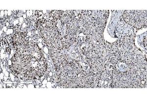IHC analysis of MCM6 using anti-MCM6 antibody (ABIN7600036). (MCM6 抗体  (AA 14-821))