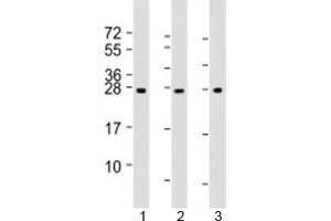 Western blot testing of human 1) human liver, 2) RPMI-8226 and 3) SH-SY5Y lysate with NT5M antibody at 1:2000. (NT5M 抗体  (AA 195-226))
