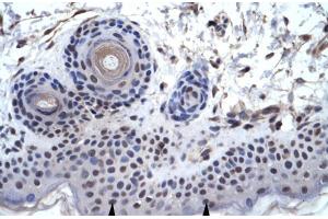 Human Skin; ZNF660 antibody - C-terminal region in Human Skin cells using Immunohistochemistry (ZNF660 抗体  (C-Term))