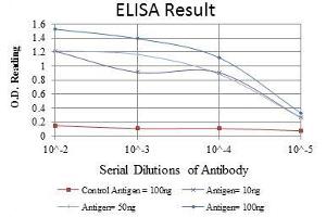 Red: Control Antigen (100 ng), Purple: Antigen (10 ng), Green: Antigen (50 ng), Blue: Antigen (100 ng), (Aurora A 抗体)
