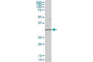 Western Blotting (WB) image for anti-Eukaryotic Translation Initiation Factor 2B, Subunit 1 Alpha, 26kDa (EIF2B1) (AA 1-305) antibody (ABIN515199)