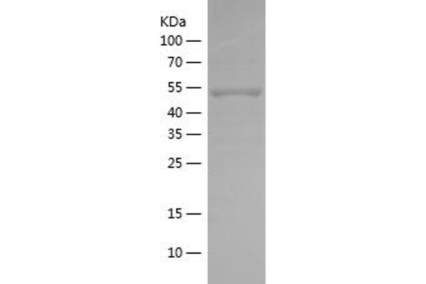 PRKAB1 Protein (AA 62-269) (His-IF2DI Tag)