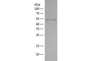 PRKAB1 Protein (AA 62-269) (His-IF2DI Tag)