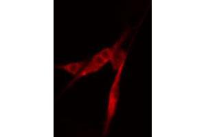 ABIN6274217 staining COLO205 cells by IF/ICC. (APEX1 抗体  (N-Term))