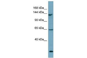 Western Blotting (WB) image for anti-LATS, Large Tumor Suppressor, Homolog 1 (Drosophila) (LATS1) (Middle Region) antibody (ABIN2787626)