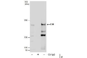 Immunoprecipitation (IP) image for anti-Excision Repair Cross-Complementing Rodent Repair Deficiency, Complementation Group 6 (ERCC6) (Internal Region) antibody (ABIN2855858)