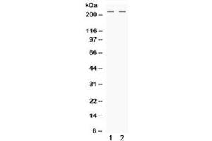 Western blot testing of human 1) HeLa and 2) HepG2 cell lysate with Nestin antibody. (Nestin 抗体)