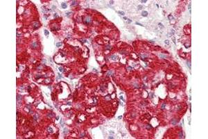 Immunohistochemical analysis of paraffin-embedded human adrenal tissues using STYK1/NOK mouse mAb with DAB staining. (STYK1 抗体)